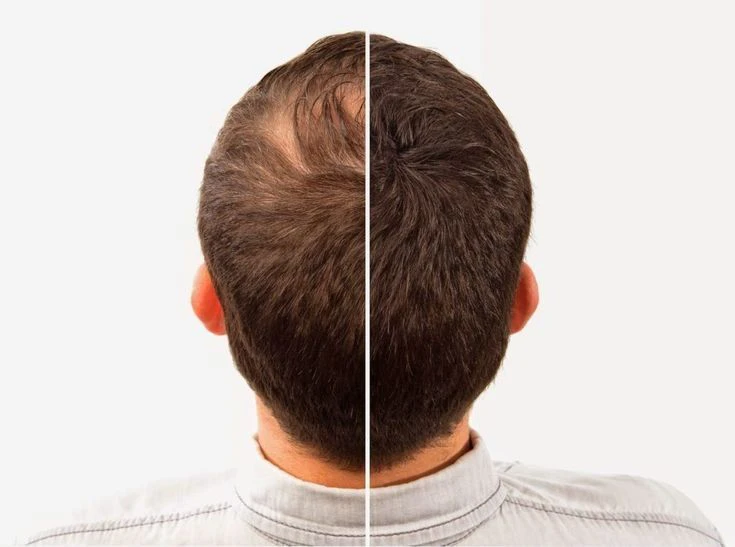 Nutrizione del bulbo pilifero e supporto alla crescita dei capelli